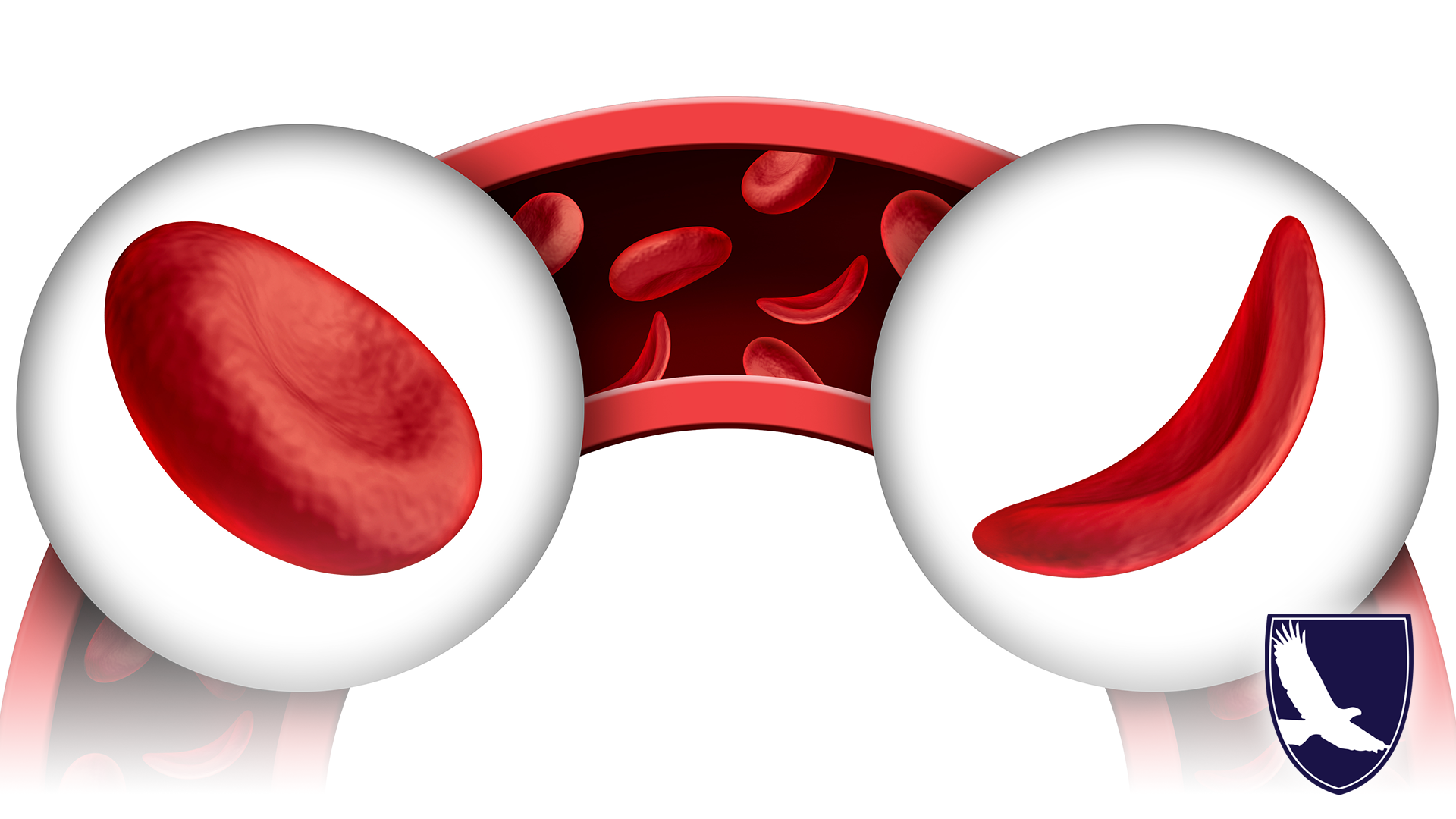 CAN I GET SOCIAL SECURITY DISABILITY FOR SICKLE CELL ANEMIA